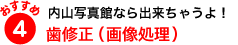 おすすめポイント４　歯修正（画像処理）